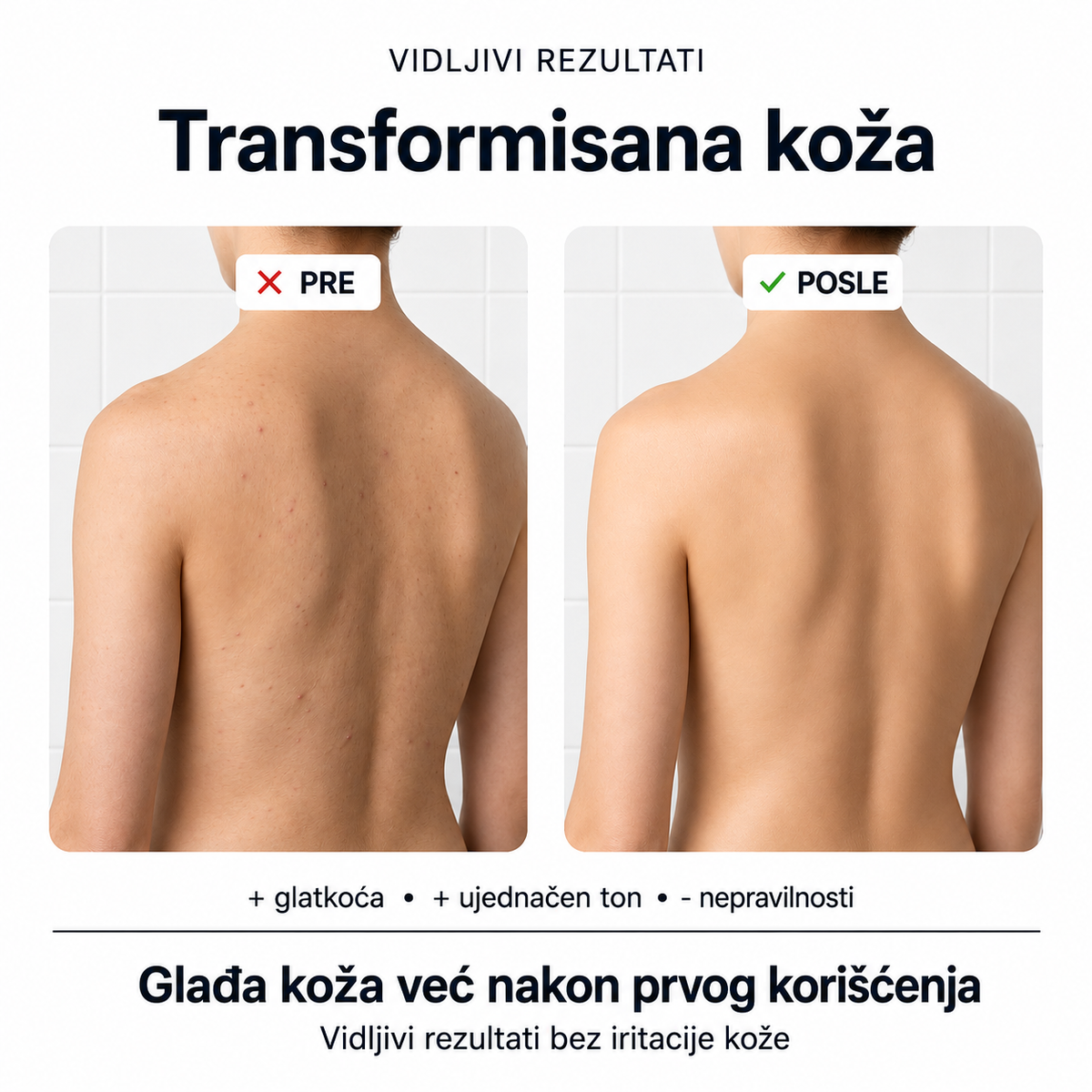SilkySkin - Piling peškir za tuširanje