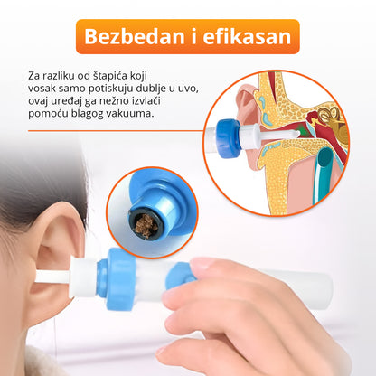 EarVac - Električni uređaj za usisavanje voska iz ušiju